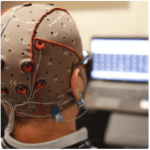 Telepathy se convirtió en el primer chip cerebral implantado en un ser humano